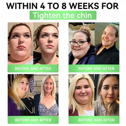 🧑‍⚕️Official Store| Alcuras™ Moringa × Berberine × AMPK 8-Benefit Slimming & Metabolic Nano Microneedle Patch 🇺🇸  Just once a day · Visible changes in 7 days  ✅ For obesity, loose skin, diabetes, sleep apnea, joint issues, and more
