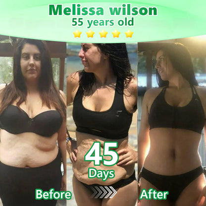 Official Store🧑‍⚕️| Alcuras™ Moringa × Berberine × AMPK 8-Benefit Slimming & Metabolic Nano Microneedle Patch 🇺🇸  Just once a day · Visible changes in 7 days  ✅ For obesity, loose skin, diabetes, sleep apnea, joint issues, and more