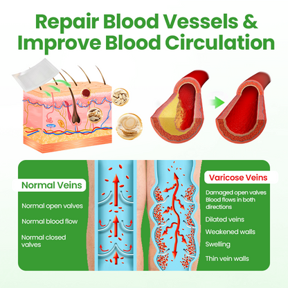 Healrize® VeinHeal Microneedle Patch